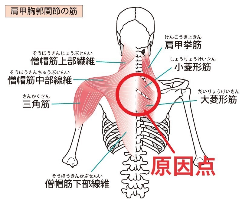 パニック障害の根本原因
