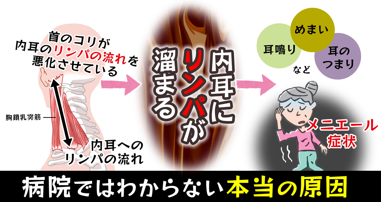 メニエール病の原因は 実は首コリにあります