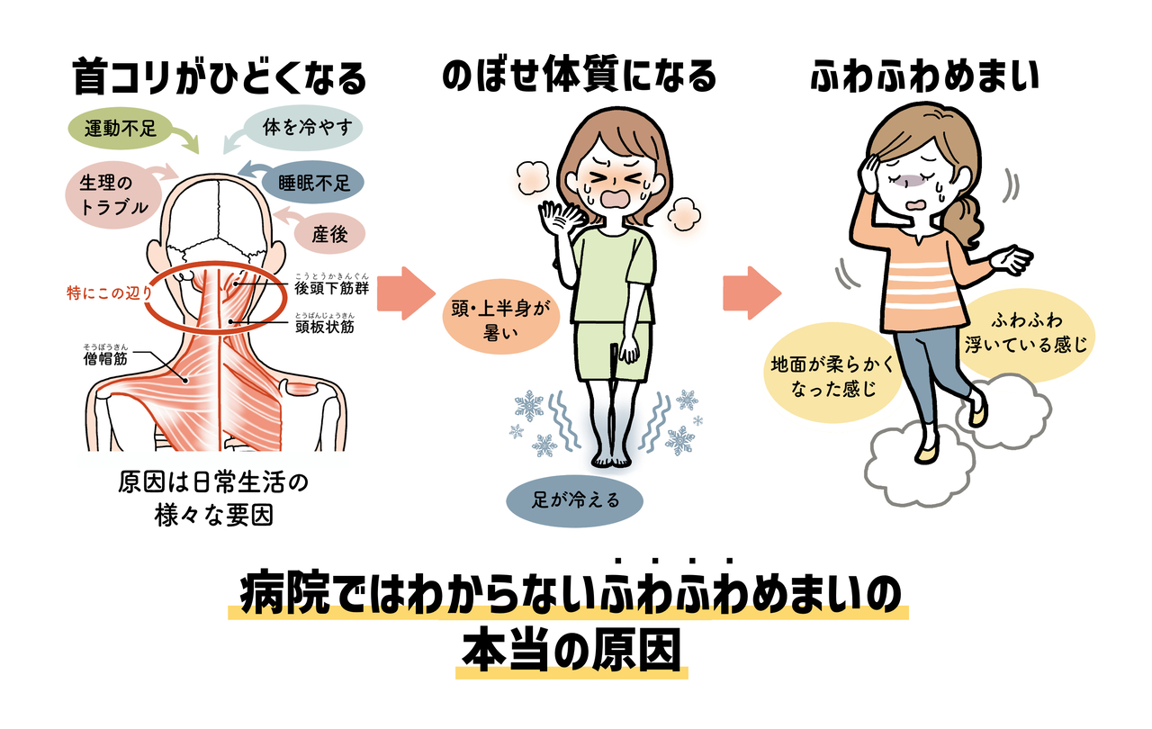 めまいの根本原因は首コリです