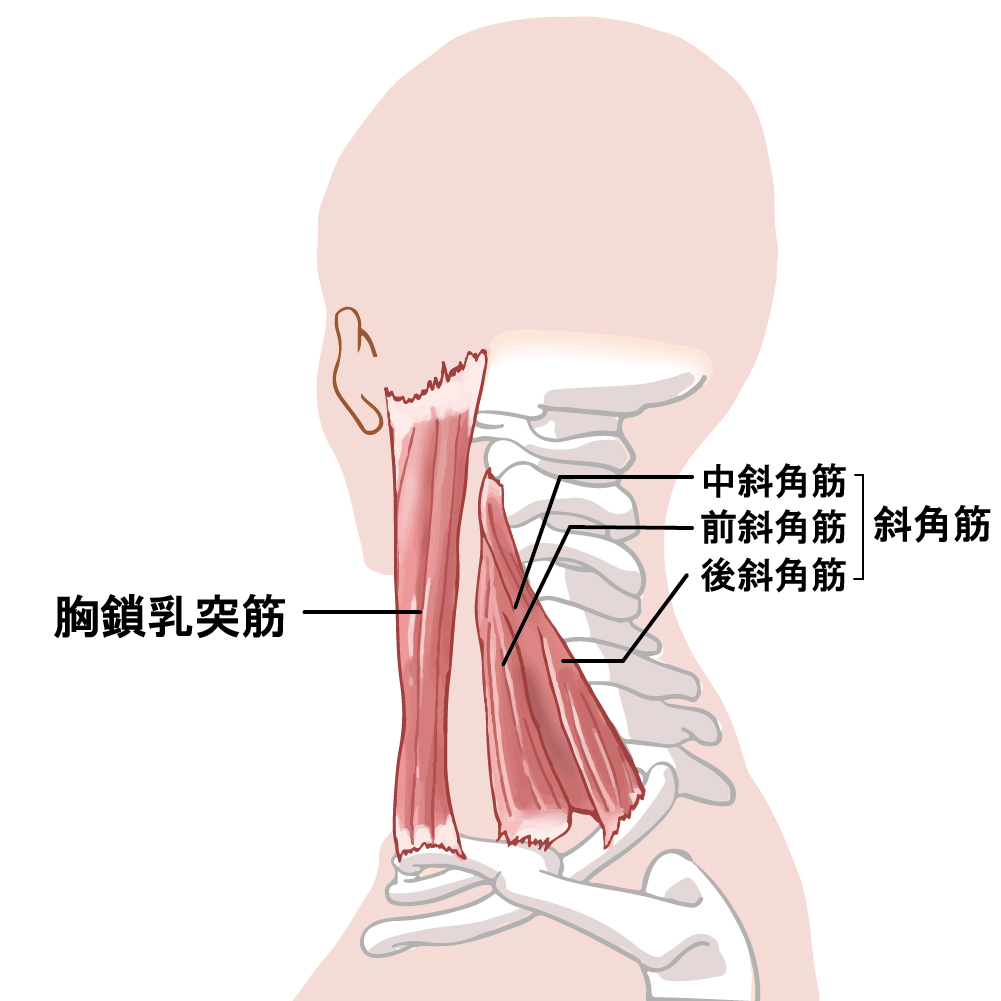 突発性難聴の原因は実は胸鎖乳突筋にあります
