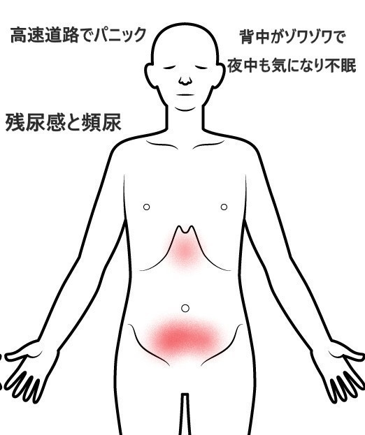 パニック障害・不安障害(息苦しさ・動悸・不安症状)の症例 - 名古屋 パニック障害・不安障害(息苦しさ・動悸・不安症状)の症例 - 名古屋