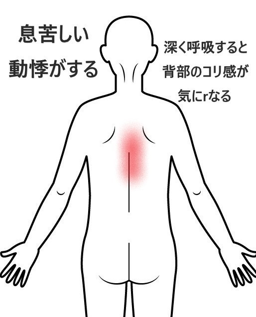 パニック障害・不安障害（息苦しさ・動悸・不安症状）の症例 - 名古屋